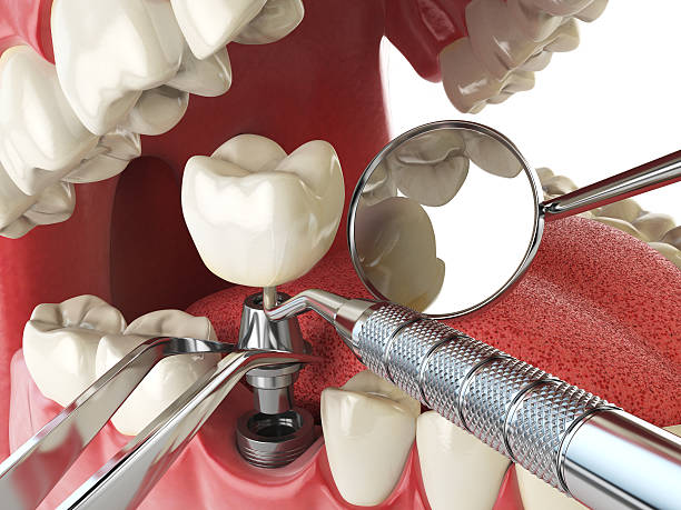 Best Emergency Care for Gum Disease in Newburg, WI