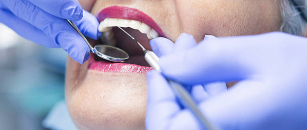 Best Emergency Root Canal Therapy in Newburg, WI