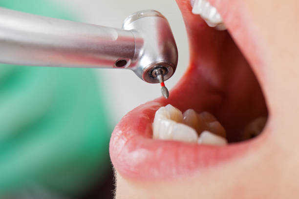 Best Broken or Chipped Tooth Repair in Newburg, WI